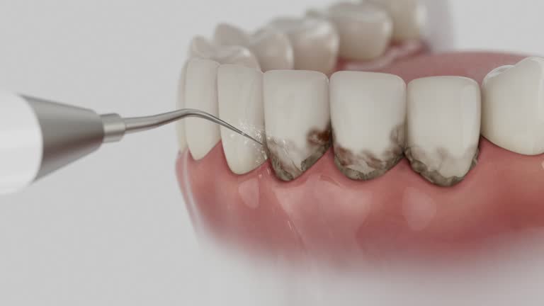 Trusted Wisdom Tooth Removal service in Leeds, AL - Dentist Open Now